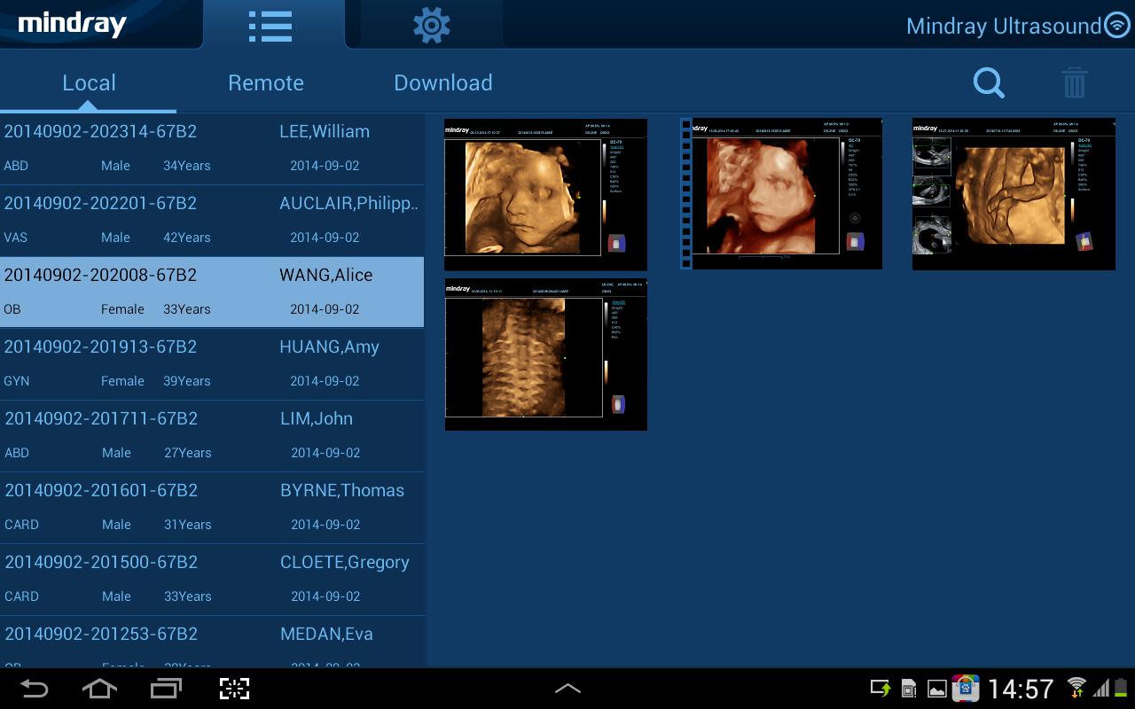 MedSight HD