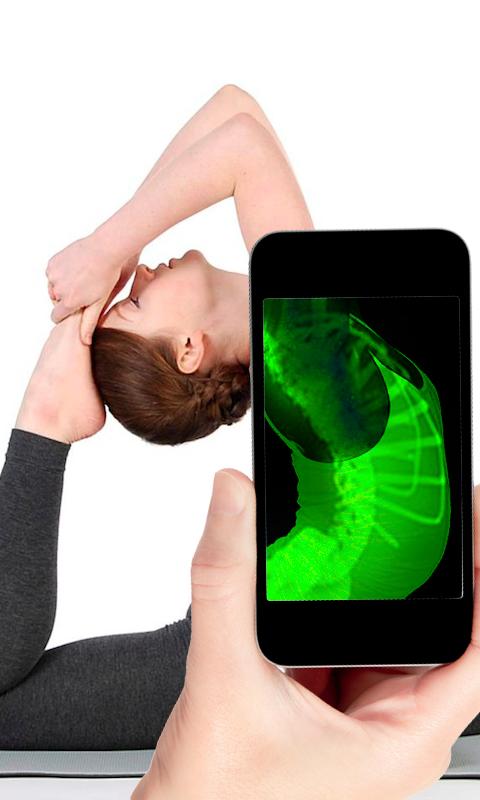 X-Ray Simulator : Prank