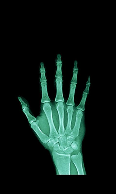 Ultrasound X Ray Scanner